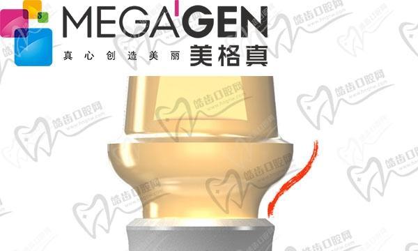 美格充电器（解析美格充电器的性能和优势，了解其市场反馈和用户口碑）-第3张图片-星耀数码
