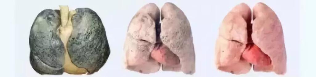 二手烟的危害与防范（从健康到环境，了解二手烟的危害和保护方法）-第3张图片-星耀数码